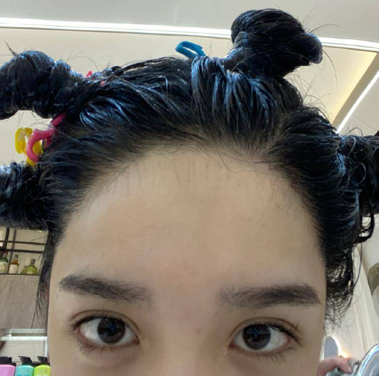 植发|继蔡萝莉之后，艾比也被爆出整容植发，清纯形象再也找不到了