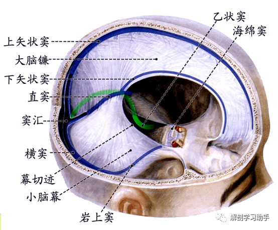 解剖影像颅底和脑的血管