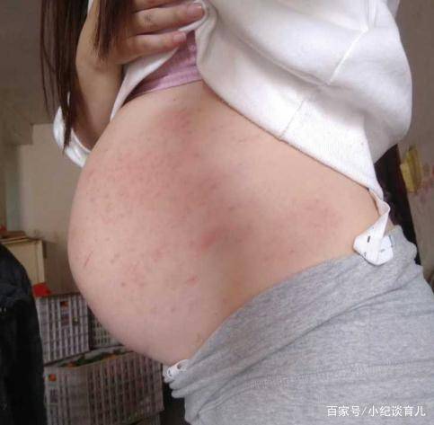 怀孕多久有胎心胎芽最早 98f6bb0a78b4439abc2096ca0fd0a7e7.jpeg