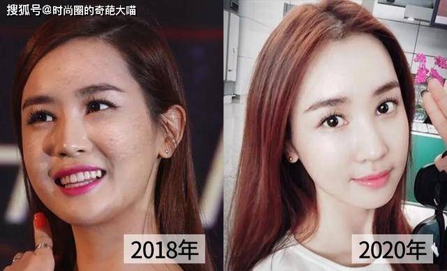 什么|李多海的脸遭遇了什么!坑坑洼洼粉都填不平,没了滤镜颜值太真实