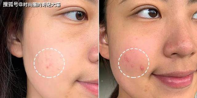 什么|李多海的脸遭遇了什么!坑坑洼洼粉都填不平,没了滤镜颜值太真实