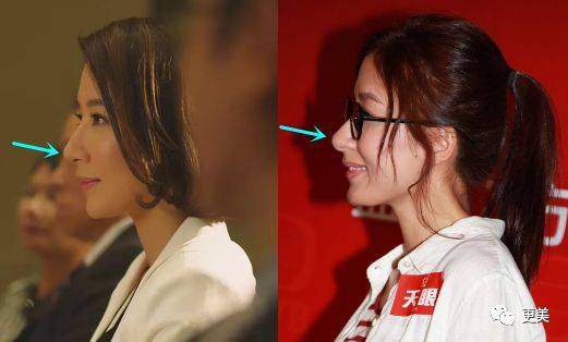 杨怡|曾经tvb一姐，演技一流，也把自己整僵了，假体太明显了...