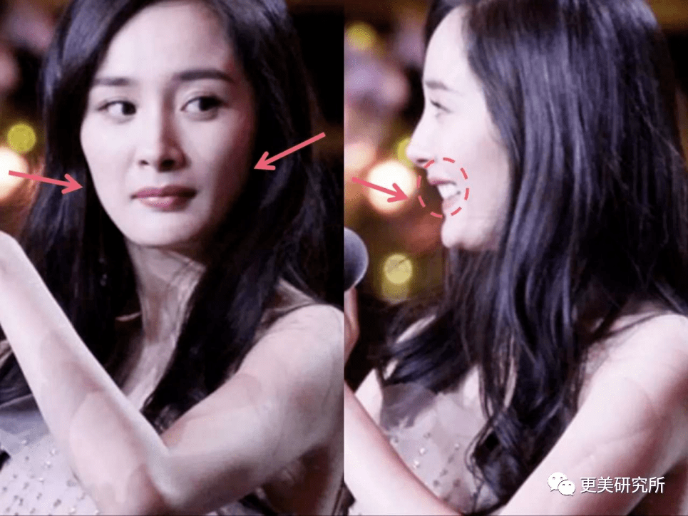 do|贵圈削骨图鉴 | 三代100个女星同时削掉半张脸、杨幂竟还垫底...