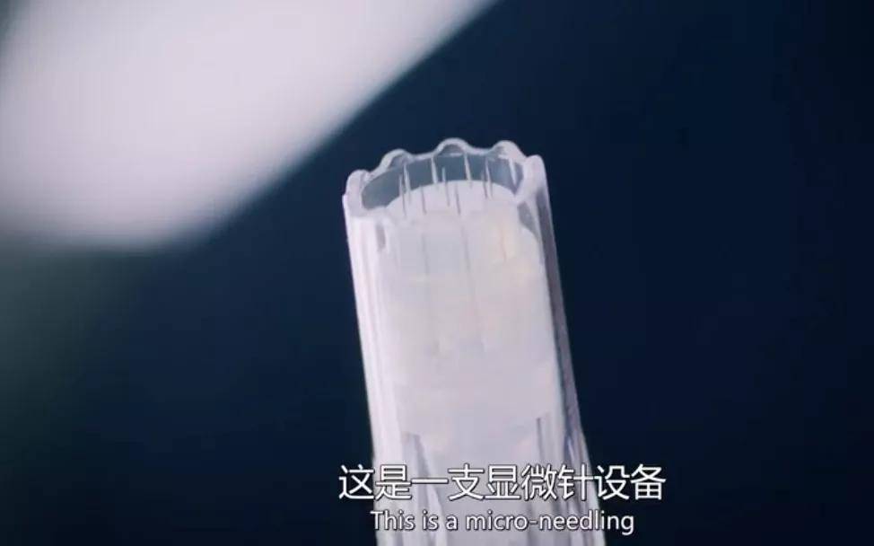 皮肤|16岁就上春晚的顶级流量，现在这脸怎么长残成这样了...