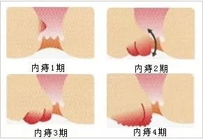 ebfdd4a2d56b45b38c266d084181bd80.png