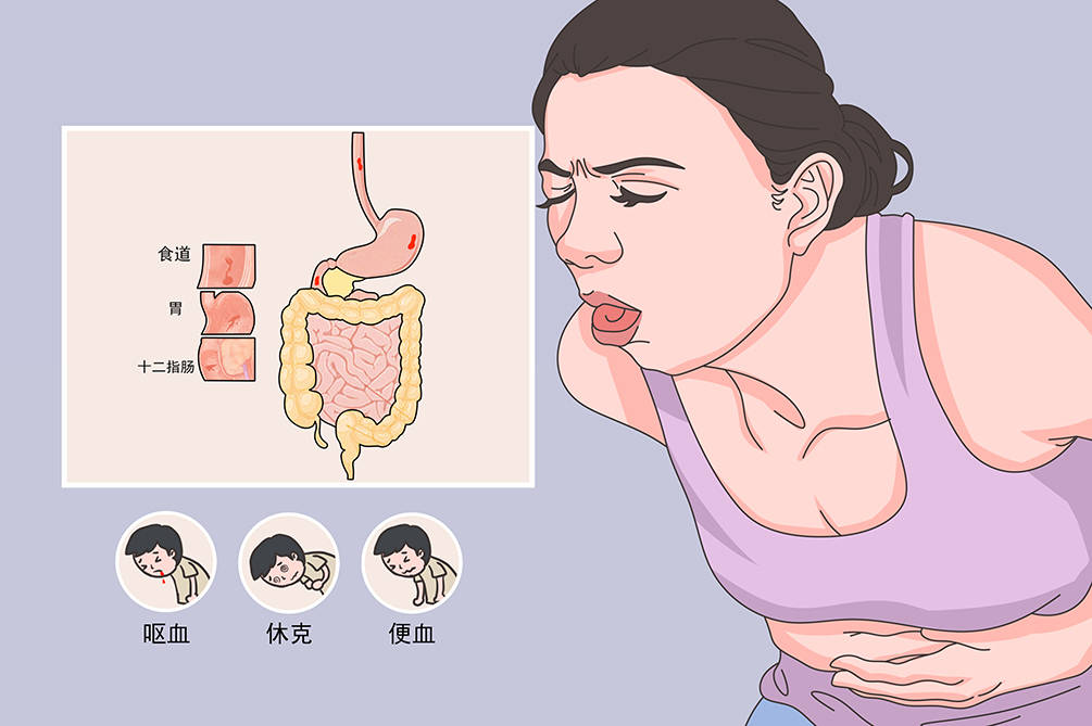 【健康教育处方】上消化道出血怎么办?消化内科告诉您