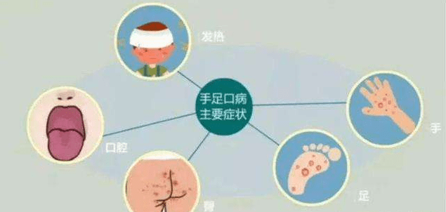宝宝手足口病,小美医生不打针不吃药三天调理见效,宝妈从怀疑到信任无