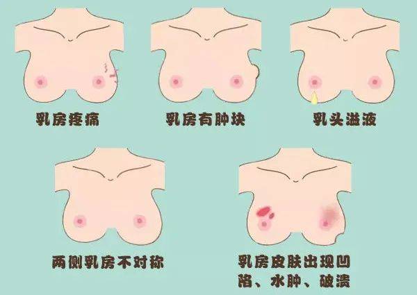 1,乳房的大小,形状发生改变. 2,乳头的形状,位置(如乳头内陷)变化.