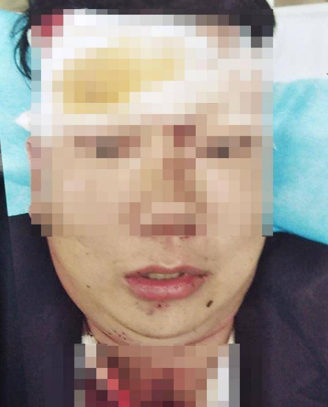 抓人口罩被打_戴口罩的卡通图片