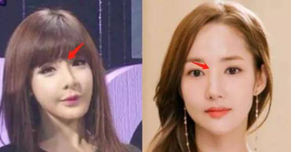 朴敏英|9年换5次头，do得毫无痕迹，双眼皮竟然还都是亲爸割的...