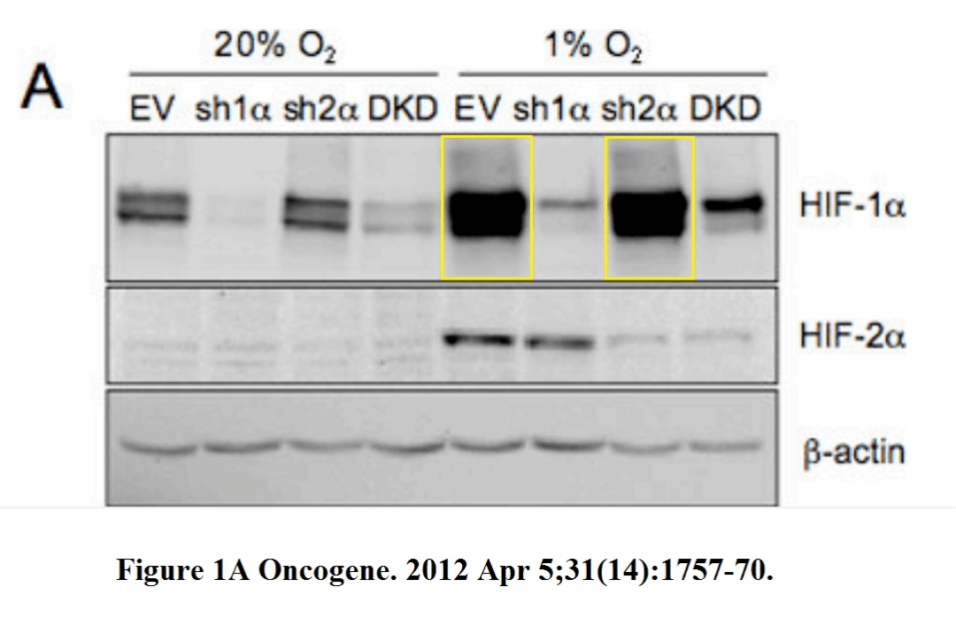 塞门扎|去年诺奖得主涉嫌学术造假！30多篇论文被曝P图、复制粘贴
