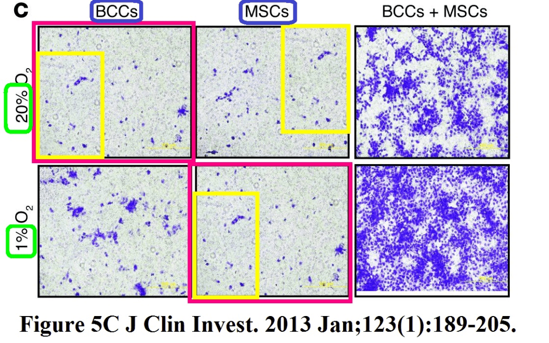 塞门扎|去年诺奖得主涉嫌学术造假！30多篇论文被曝P图、复制粘贴