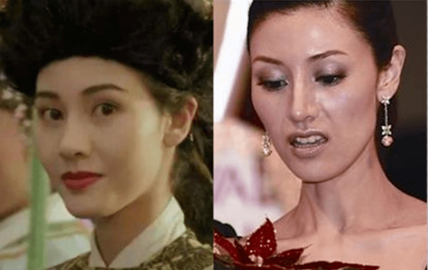 赵丽颖|鞠婧祎和赵丽颖竟然是同一个医生？