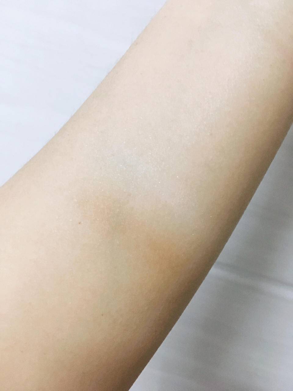 下巴|看完这篇再决定要不要打瘦脸针！不用P图双下巴也能byebye