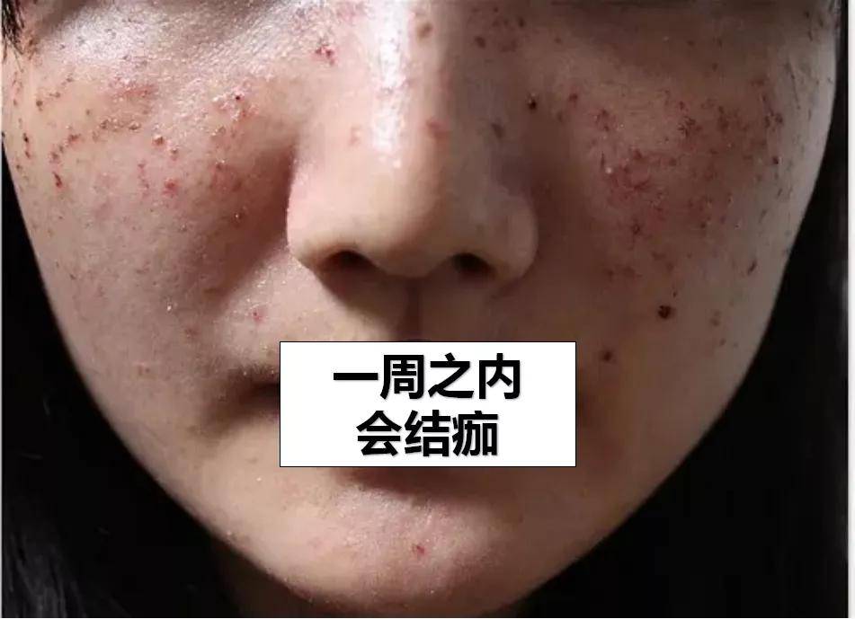 斑点|美到甘愿被她抢老公，王思聪新盯上的“女友”到底赢在哪？