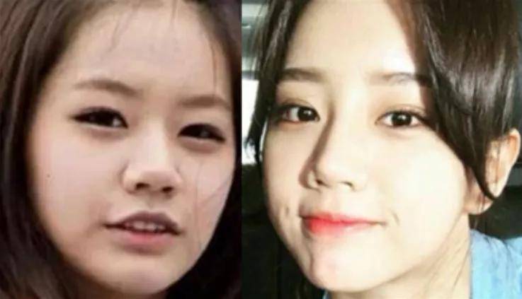 李惠利|女明星最绝大鼻头变身记！娜扎do鼻子前应该找她取经1000次...