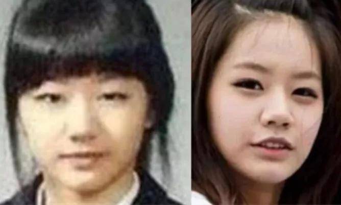 李惠利|女明星最绝大鼻头变身记！娜扎do鼻子前应该找她取经1000次...