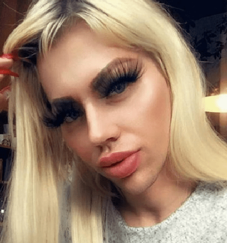 小哥|跨越次元界限，26岁男生沉迷整容“芭比娃娃脸”，这也不好看啊