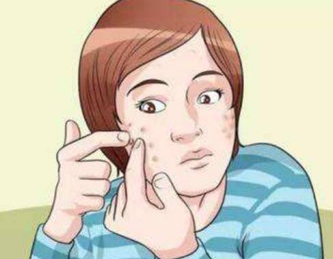 医学虽然发达,但是有些痘印不建议用激光 千万别花冤枉钱