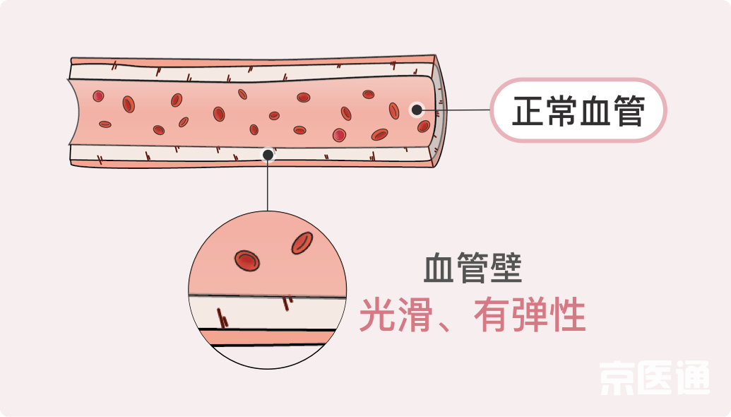 什么血为什么成语_成语故事图片(3)