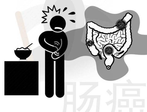 医生忠告:排便若有这4种异常,暗示肠癌或已上门,需重视