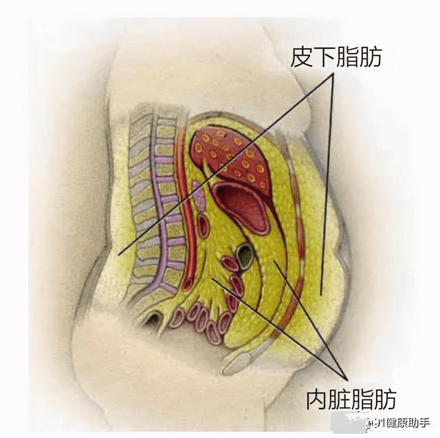 皮下组织脂肪也是好东西理智减肥才是王道