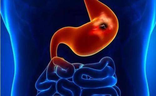 c83857df682d418286fe508e704b9824.jpeg
