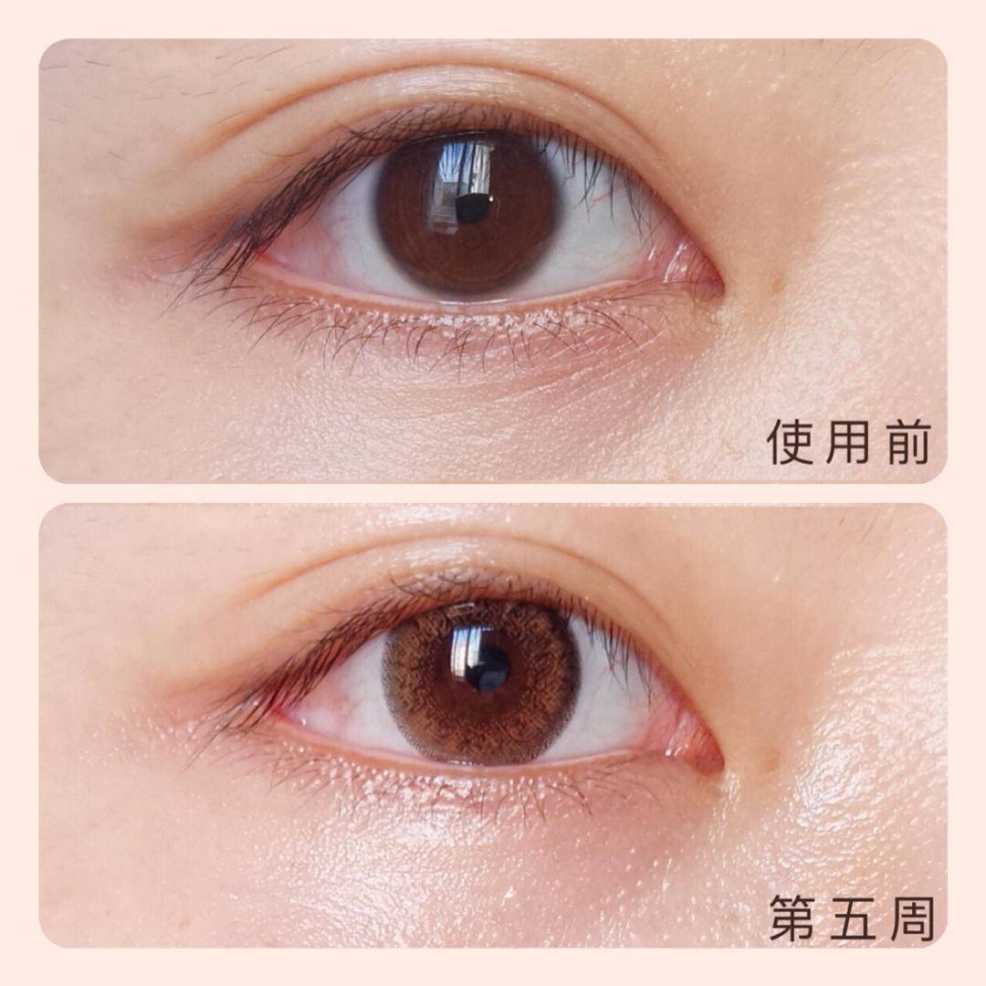 肌肤|永远的花样少女，跟国民女神陈妍希一起幸福下去吧！