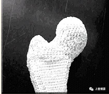 生物3D打印技术的概述