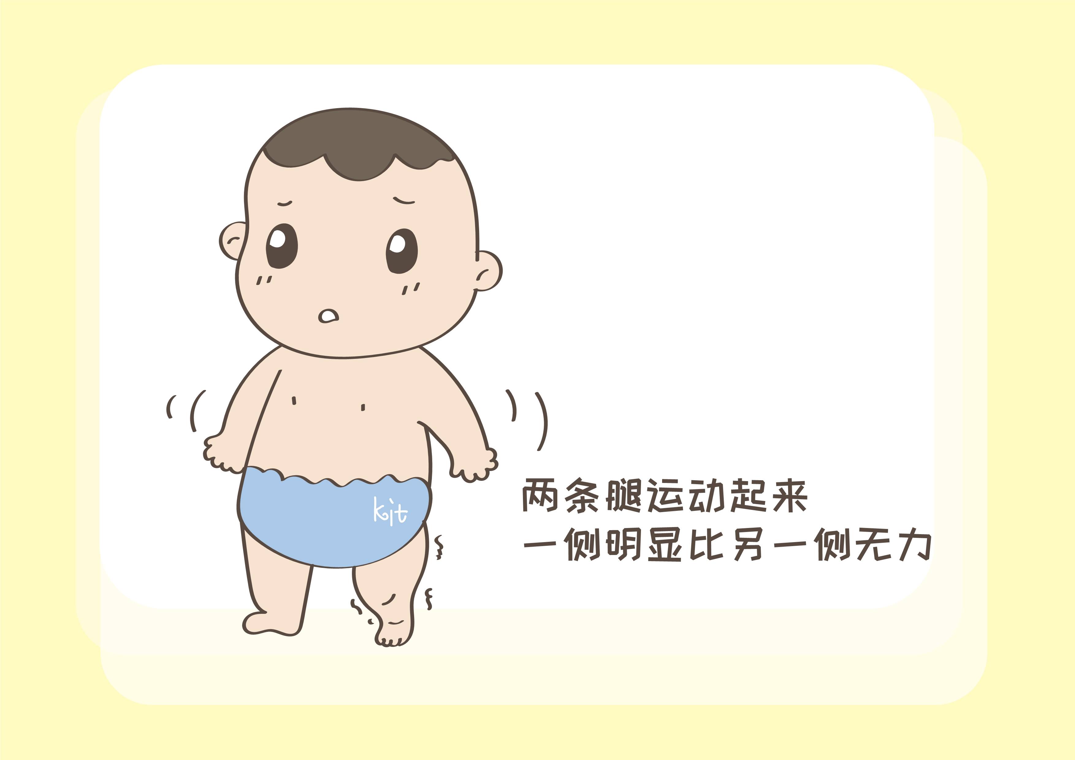 孩子|宝宝的大腿纹为啥不对称？这是什么情况？带你一起了解下