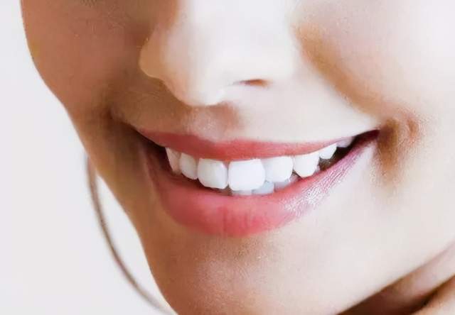 美牙贴面当下正流行,问题来了:牙贴面的使用寿命能维持多久呢?