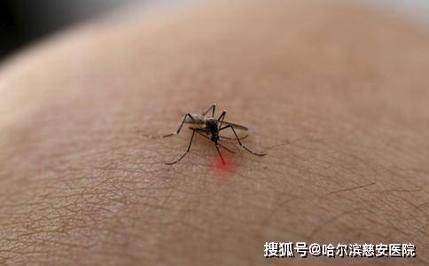二是指昆虫叮咬皮肤后出现的局部或全身性过敏反应.