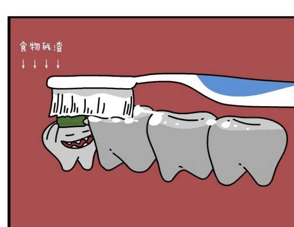 原创「健康」智齿出现这几种情况,疼不疼都必须拔!否则后患无穷