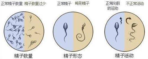 男性正常的精液是什么样的？