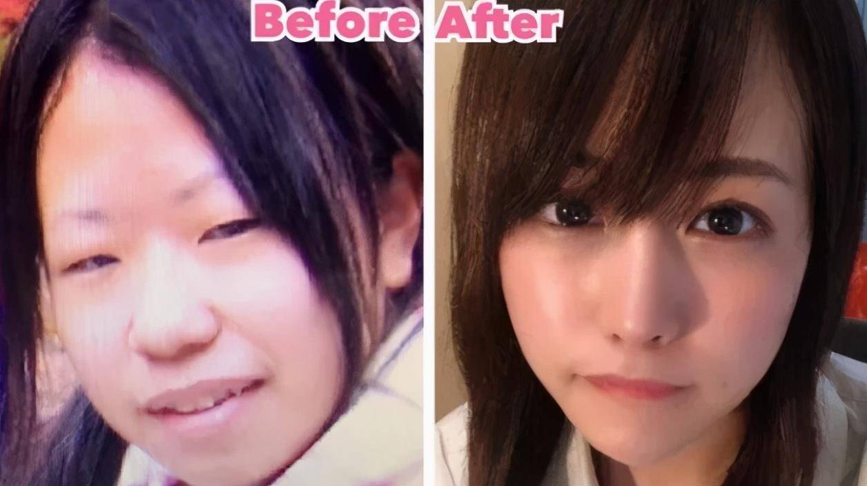 上次 羊 写完丑女仅用 25万实现换头 的真人案例后 ,好多姐妹反馈喜欢