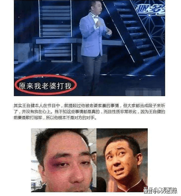 王自健自曝家庭暴力,晒图鼻青脸肿!网友:一场闹剧!