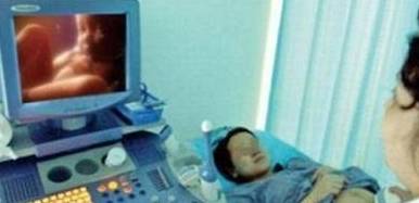 几周胎停的几率大 de11665500e44192847b6533a1e2eae1.jpeg
