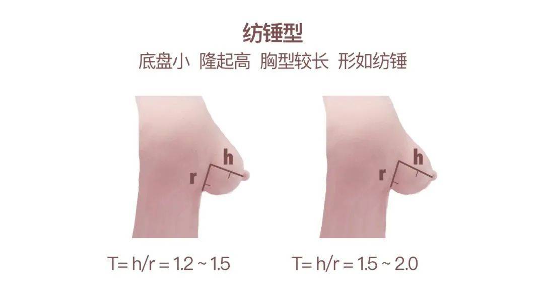 原创雅衣曼体产后乳房缩水下垂如何预防和恢复