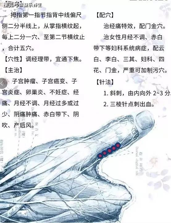 董氏奇穴针灸---多囊卵巢综合症处方:肩六,妇科穴,还巢穴,下三皇,太冲