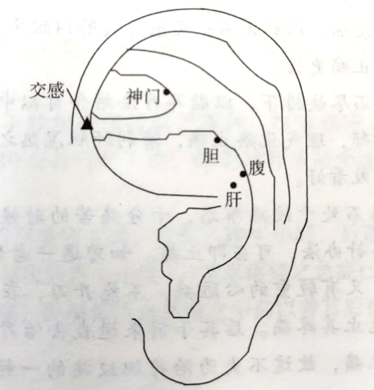 【治疗(1)取耳穴:胆,肝,腹,交感,神门(如图.