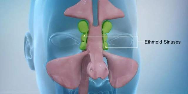 只知道鼻窦炎的可怕?可知道鼻窦的作用