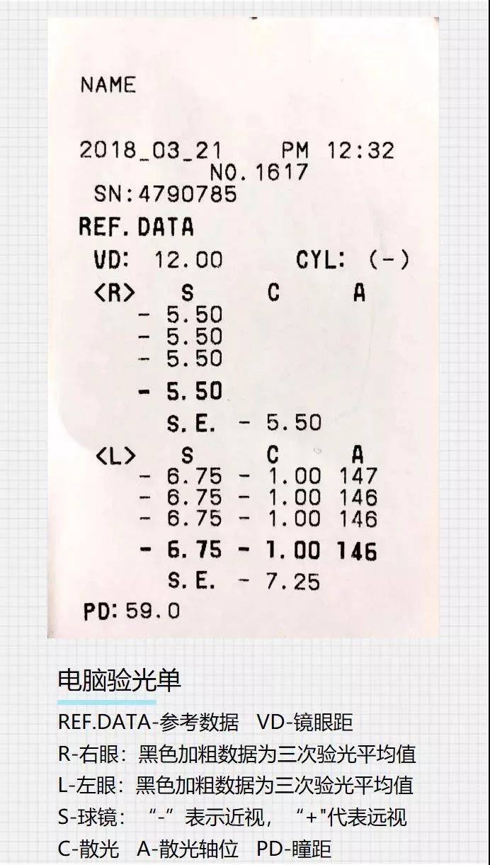 三分钟教你"破译"验光单上的奥秘!