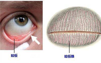 睑板腺是全身最大的皮脂腺,位于眼睑上下睑板之中,垂直于睑缘排列,并