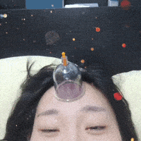 在我额头拔火罐,可以