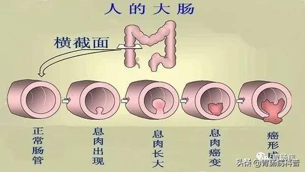 怎么样能快速忘记一件事情 3f829100196541149ca42b2df3e560b8.jpeg