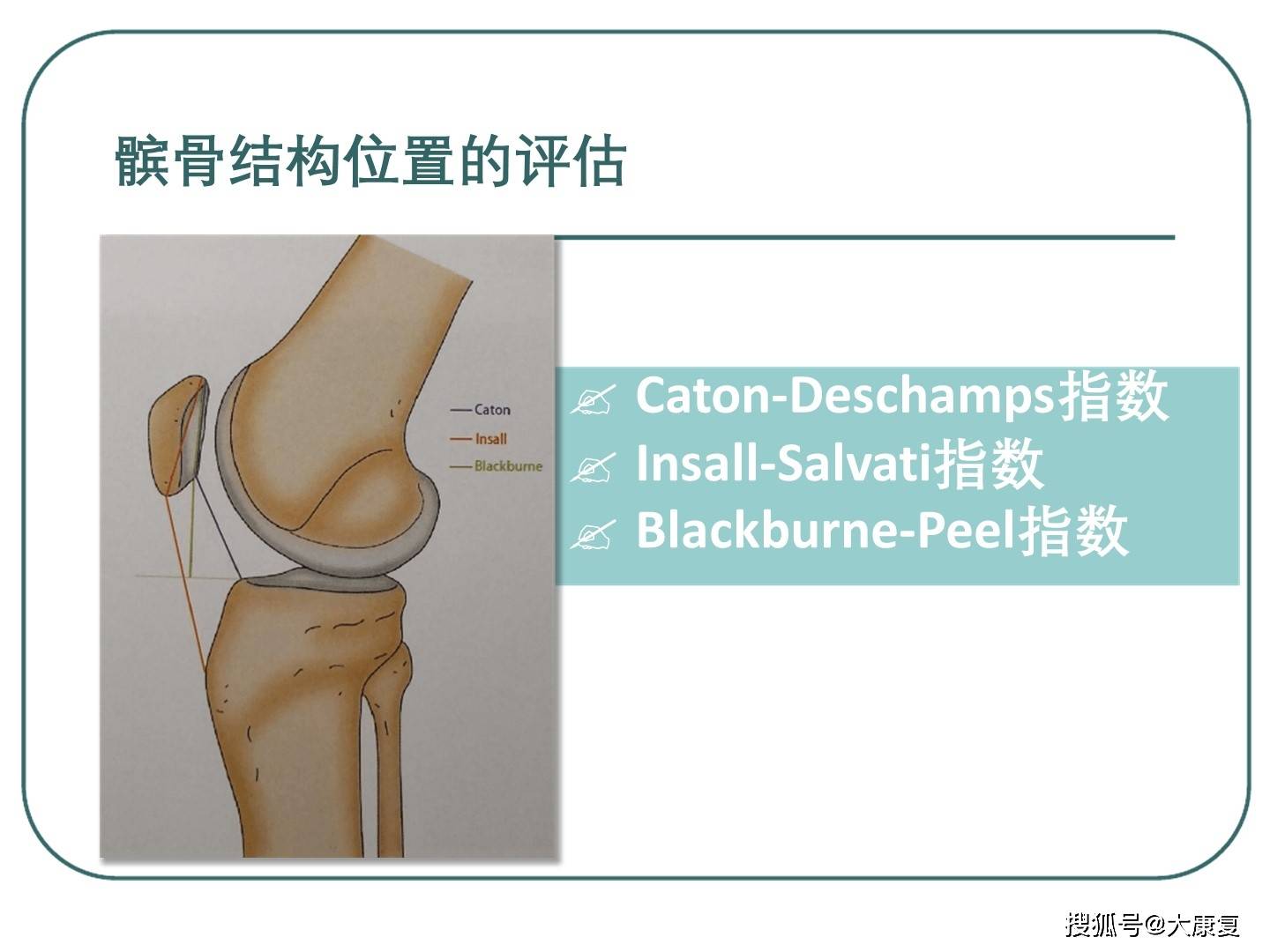 髌股关节生物力学浅识