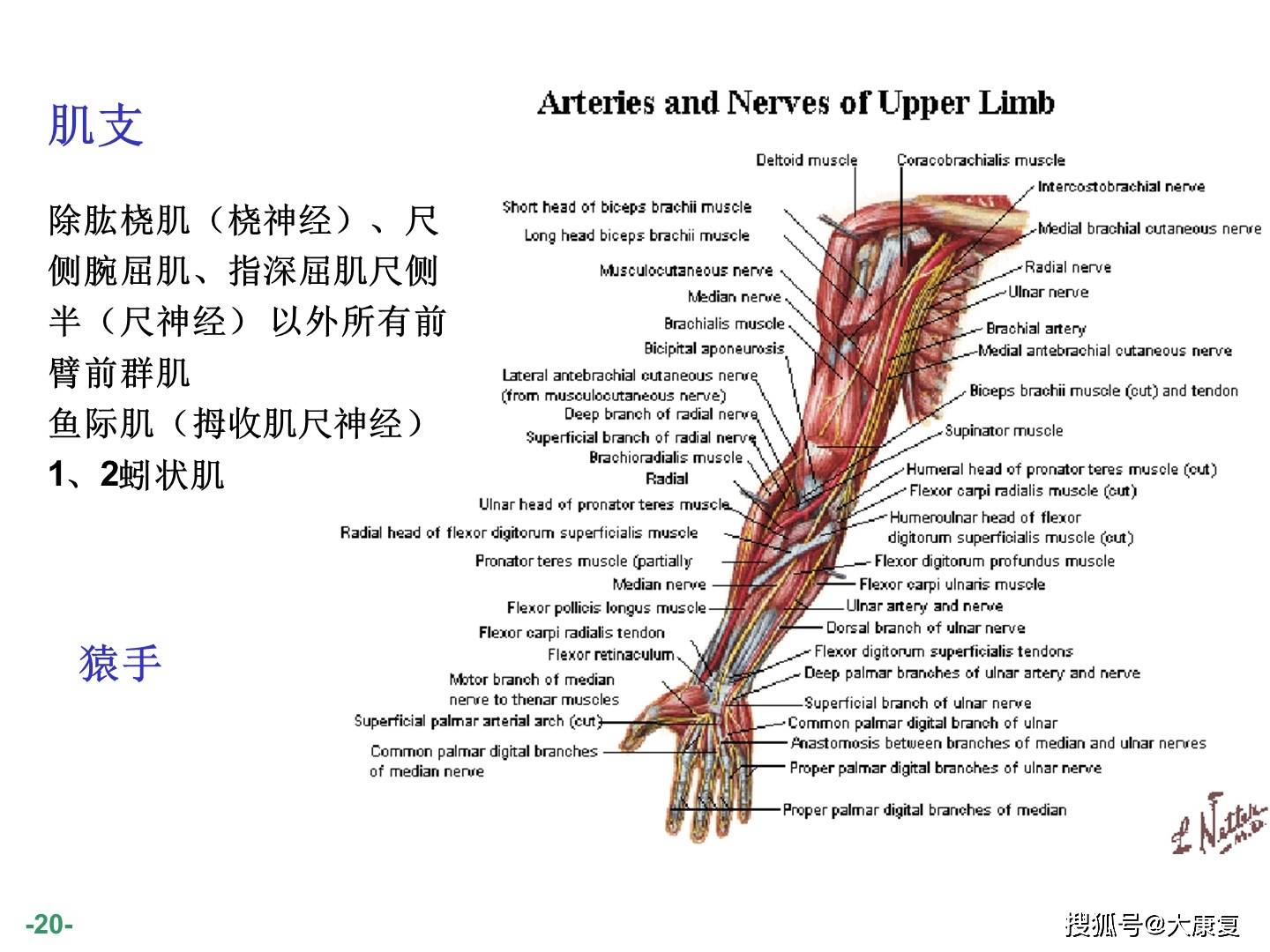 臂丛神经解剖图谱
