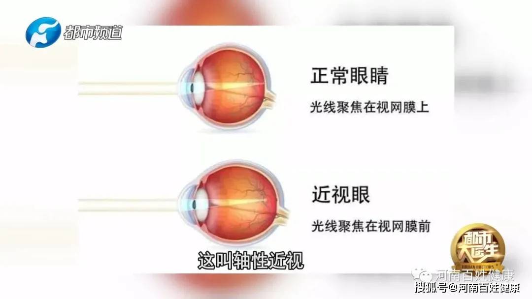 《寒假孩子近视度数咋样才能零增长》河南广播电视台都市大医生1月28
