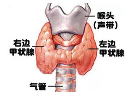 注意桥本氏甲状腺炎会引起大脖子病