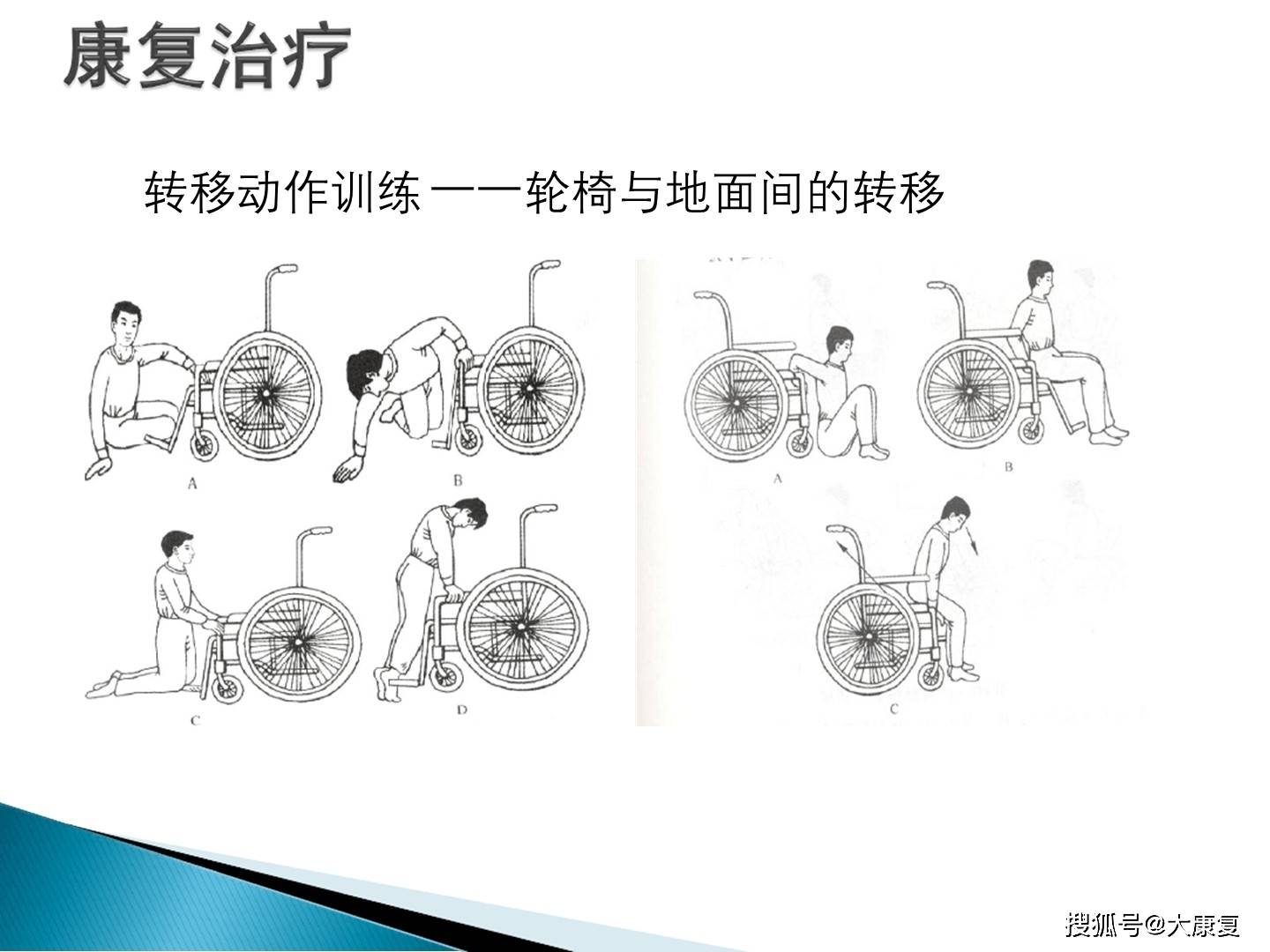 脊髓损伤的步行功能训练